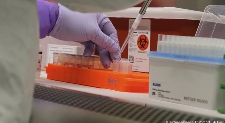 Путин объявил о возможном выпуске в апреле российско-японского теста на коронавирус